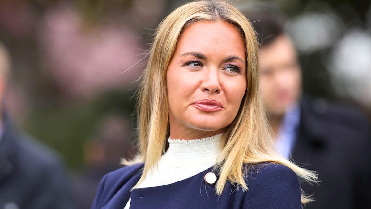 Vanessa Trump duck lips